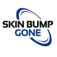 BUMP BE GONE Logo
