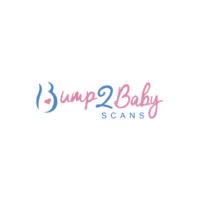 Bump 2 Baby Scans Logo