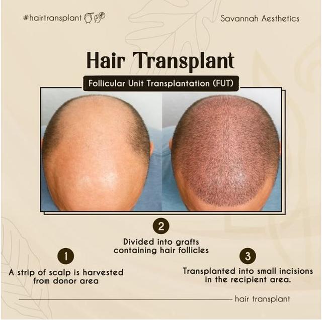 Best_Hair_GFC_Treatment_Ahmedabad___Savannah_Aesthetics.jpeg